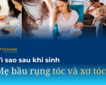 Vì sao sau khi sinh, mẹ bầu bị rụng và xơ tóc? Cách phục hồi an toàn cho mẹ bỉm