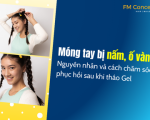 Móng tay bị nấm, ố vàng: Nguyên nhân và cách chăm sóc phục hồi sau khi tháo Gel