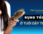 Rụng tóc ở tuổi dậy thì: Nguyên nhân và cách ngăn ngừa hiệu quả