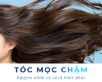 Tại sao tóc mọc chậm? Nguyên nhân và giải pháp giúp tóc phát triển khoẻ mạnh