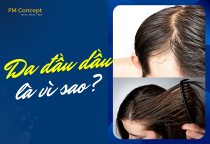 Da đầu dầu là vì sao? Cơ chế cân bằng tuyến dầu mà ai cũng nên hiểu rõ