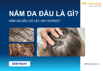 NẤM DA ĐẦU LÀ GÌ? CÓ NGUY HIỂM HAY KHÔNG?