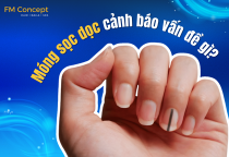 Tại sao móng tay bị sọc dọc? Móng sọc dọc cảnh báo vấn đề gì?